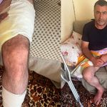 Van'da arazi anlaşmazlığı silahlı kavgaya dönüştü: 1 yaralı