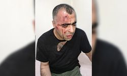 Gazeteci Sinan Aygül'e saldıranlar tutuklandı!