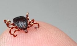 Çocuklarda keneye karşı "vücut kontrolü" uyarısı