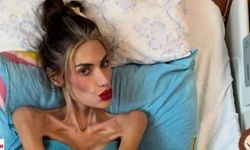 23 kiloya kadar düşen Nihal Candan yaşamını yitirdi