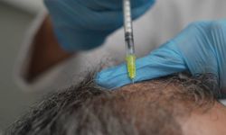 Dökülen saçlar vücudun bir alarmı olabilir