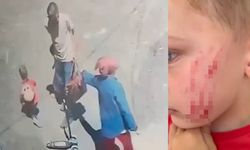 Van’da sokakta oynayan çocuğa saldırı: Kameralara yansıyan o görüntüler