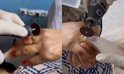 Van’da kadının parmağında sıkışan yüzük kesilerek çıkarıldı!