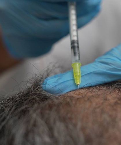 Dökülen saçlar vücudun bir alarmı olabilir