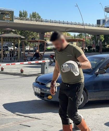 Acemi kasaplar hastaneye koştu!