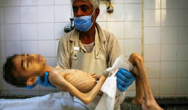 Gazze'de insanlık ayıbı: Bir çocuk daha açlıktan öldü
