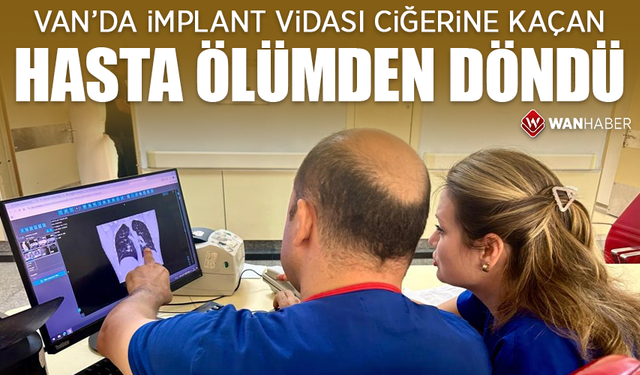 Van'da implant vidası ciğerine kaçan hasta ölümden döndü