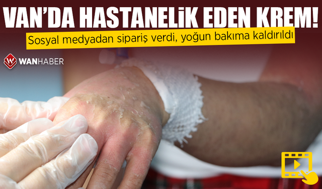 Van'da internetten sipariş verdiği krem hastanelik etti! Yoğun bakıma kaldırıldı