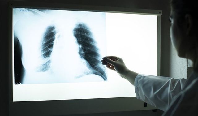 Sigara kullananlar dikkat! 4 kişiden birinde var...