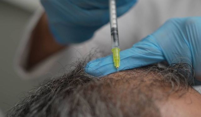 Dökülen saçlar vücudun bir alarmı olabilir