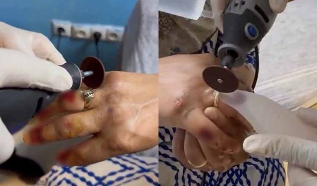 Van’da kadının parmağında sıkışan yüzük kesilerek çıkarıldı!