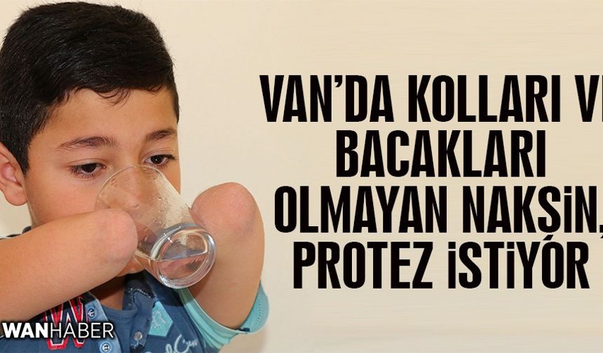 Kolları ve bacakları olmayan Nakşin, protez istiyor