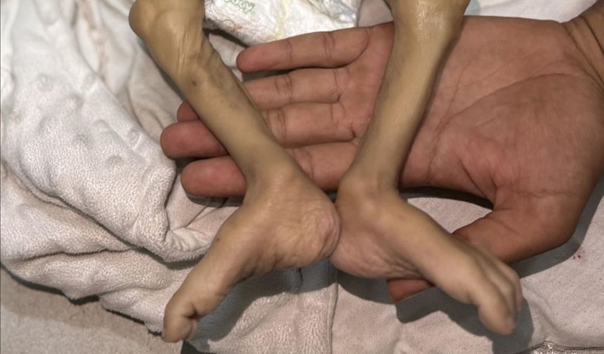 Gazze'de son 24 saatte 2'si çocuk 6 Filistinli açlıktan hayatını kaybetti