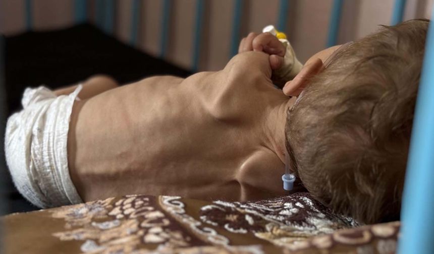 Son 24 saatte 5 kişi daha açlıktan hayatını kaybetti