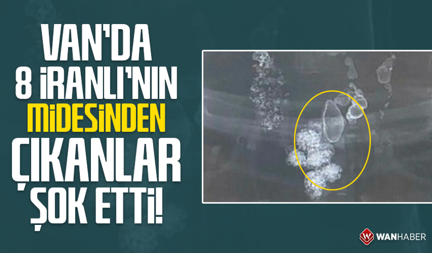 Van'da 8 İranlı'nın midesinden çıkanlar şok etti!