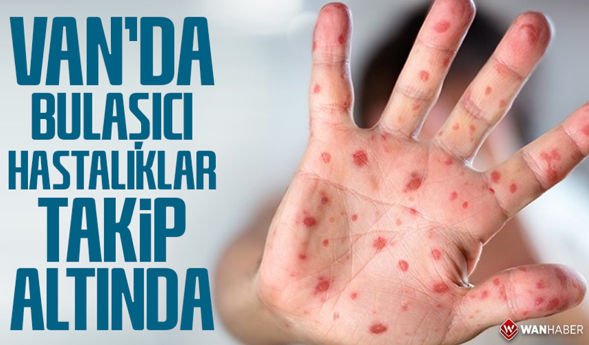 Van’da bulaşıcı hastalıklar takip altında