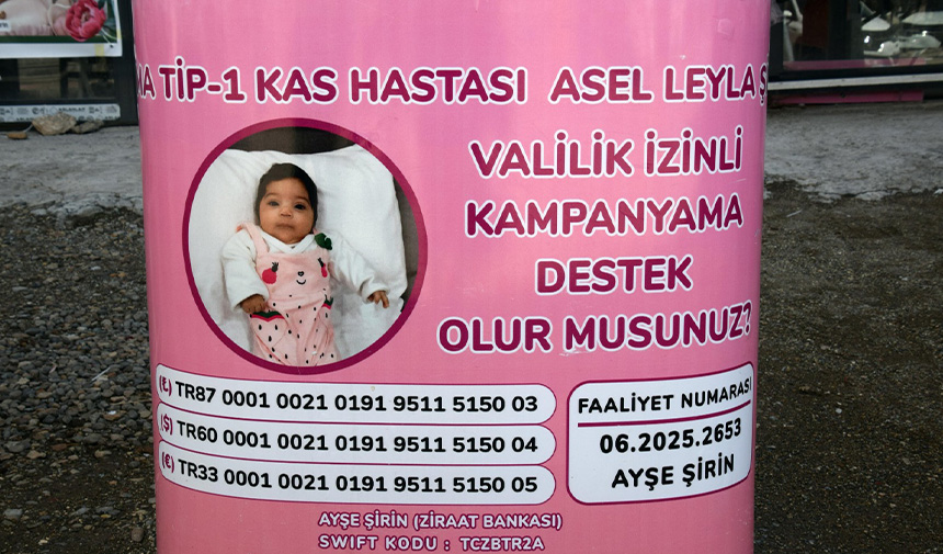 Sma Tip 1 Hastalığı