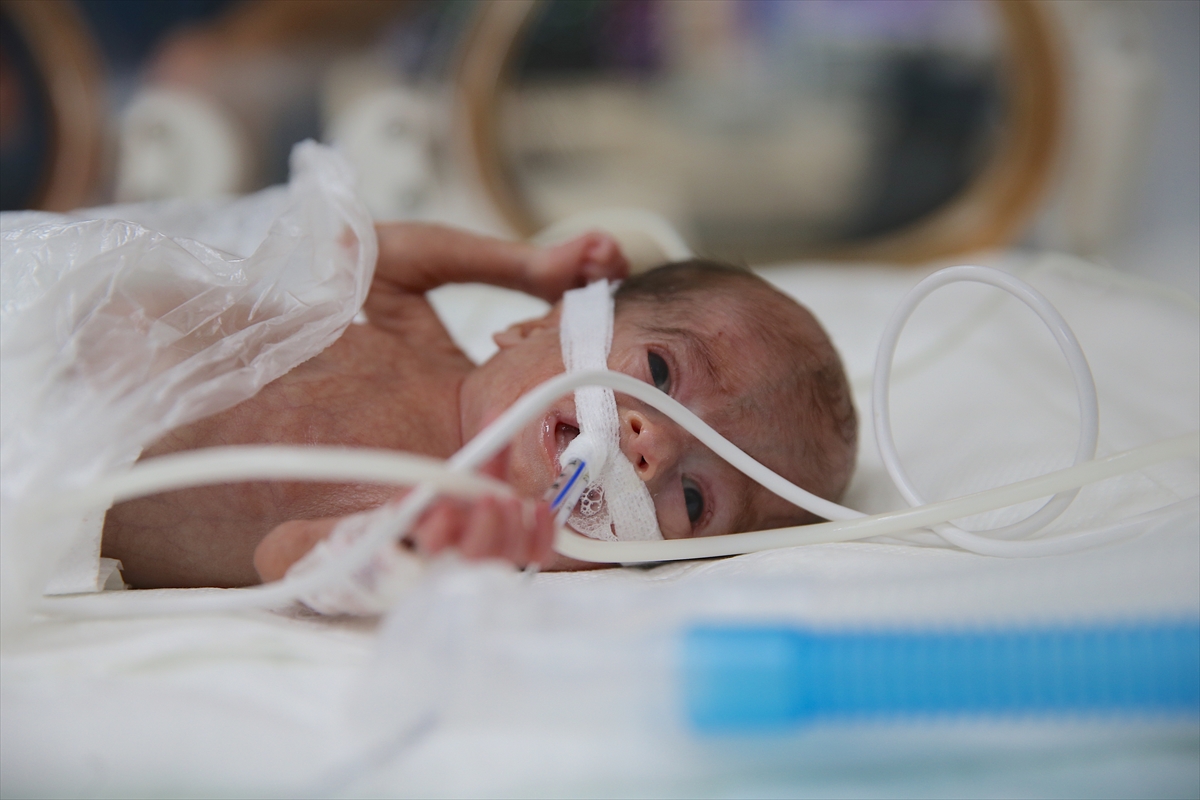 A A 20250814 38825300 38825286 P R E M A T U R E B E B E K L E R S A G L I K C A L I S A N L A R I N I N C A B A S I Y L A H A Y A T A T U T U N U Y O R