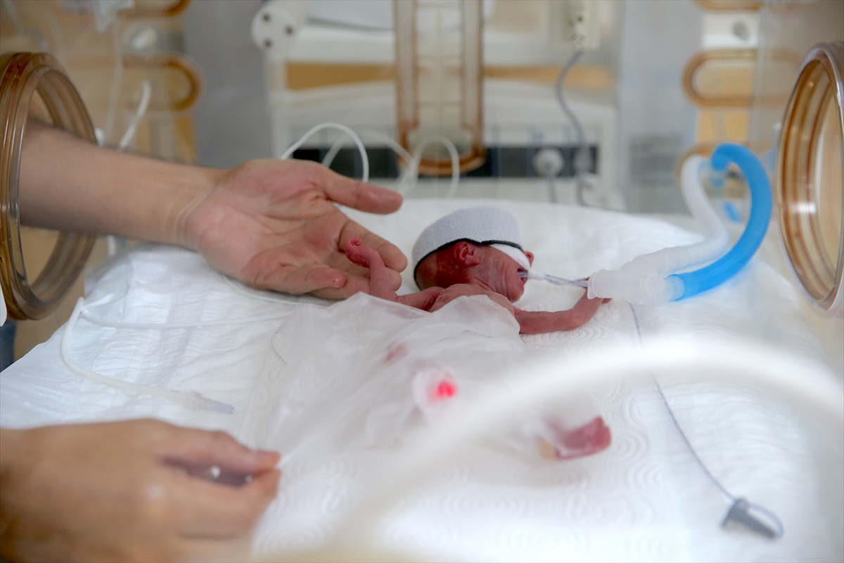 A A 20250814 38825300 38825287 P R E M A T U R E B E B E K L E R S A G L I K C A L I S A N L A R I N I N C A B A S I Y L A H A Y A T A T U T U N U Y O R