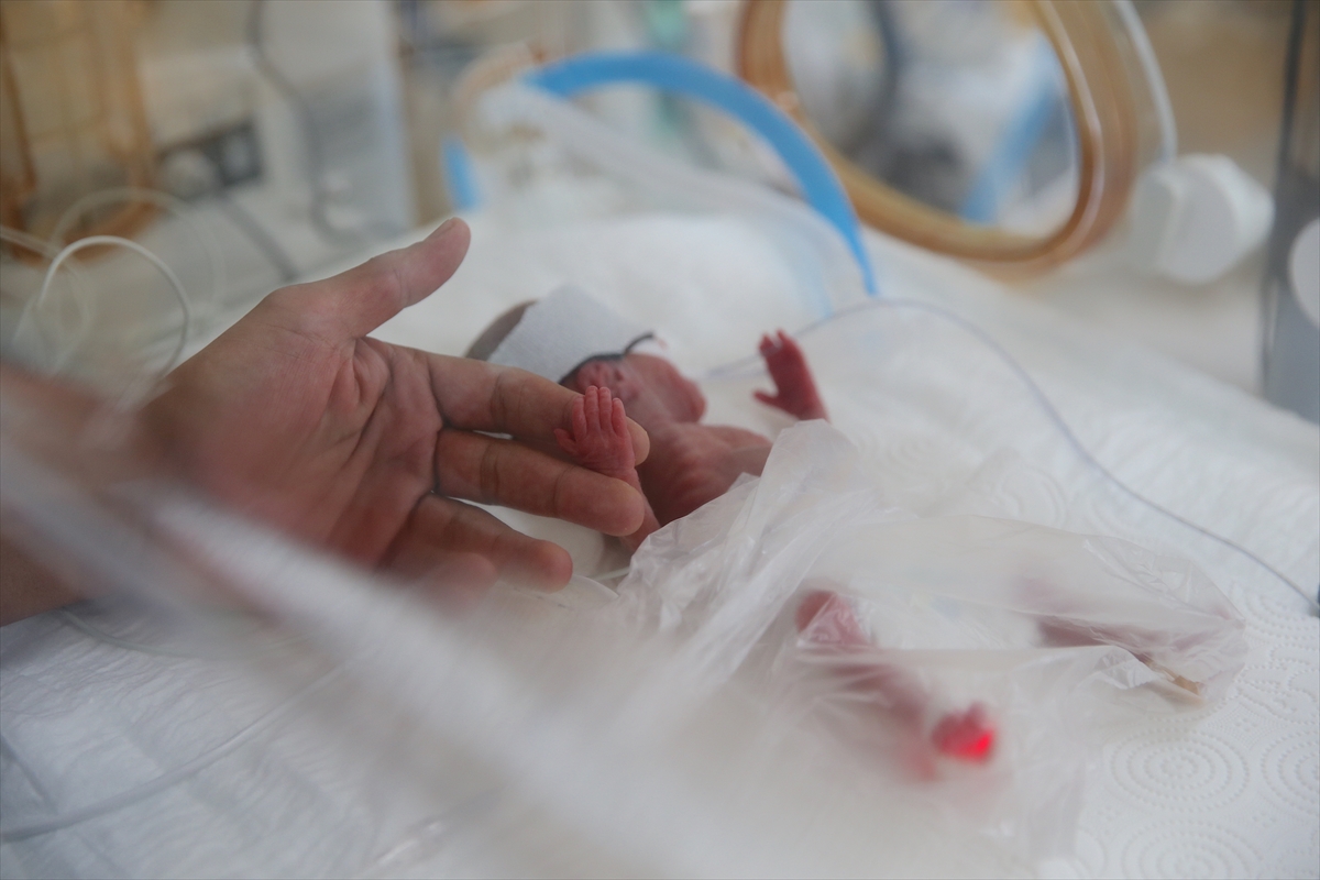 A A 20250814 38825300 38825295 P R E M A T U R E B E B E K L E R S A G L I K C A L I S A N L A R I N I N C A B A S I Y L A H A Y A T A T U T U N U Y O R