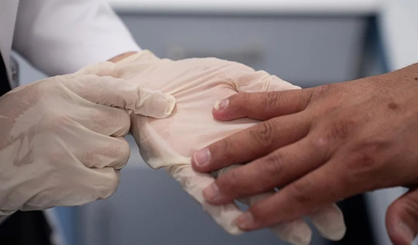 Sedef Romatizması.jpg1