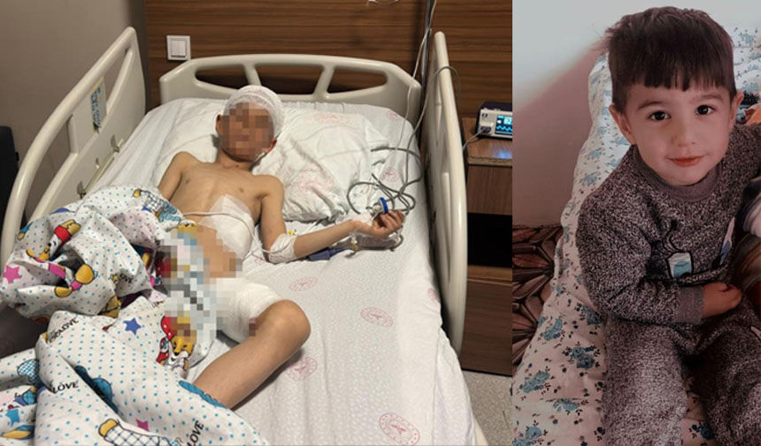 Köpek dehşetinde flaş gelişme! Belediye personeli gözaltına alındı